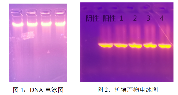 simgen-快速全血DNA小量試劑盒-2×PCR Mix -Sim-100超微量分光光度計(jì)- 電泳圖